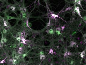 Untersuchung der Kinaseaktivität in lebenden Zellen: Wissenschaftler bauen molekulares Aufzeichnungsgerät