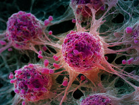 New Label-Free Imaging Tracks Cancer Treatment in Single Cells