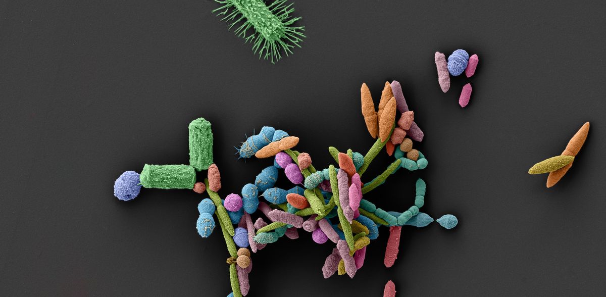 Copyright: Image produced by the Maier Lab (Lisa Maier, Anne Grießhammer, Leonardo Boldt) together with the Tübingen Structural Microscopy Core Facility (Michaela Wilsch-Bräuninger, Stefan Fischer); colouring: Elke Neudert