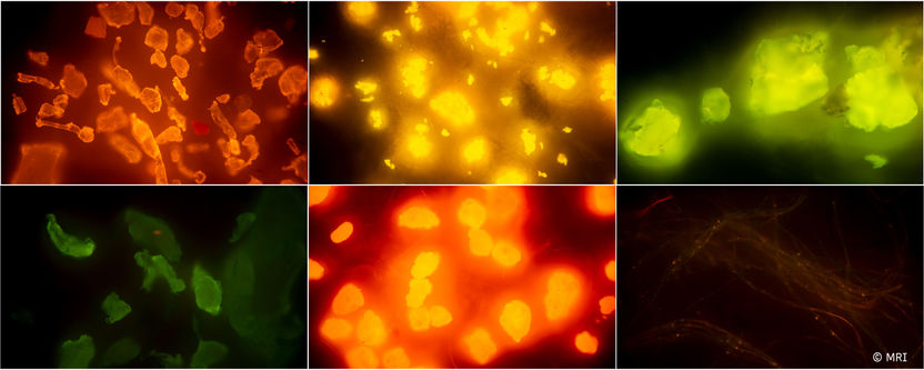 Copyright: Max Rubner-Institut