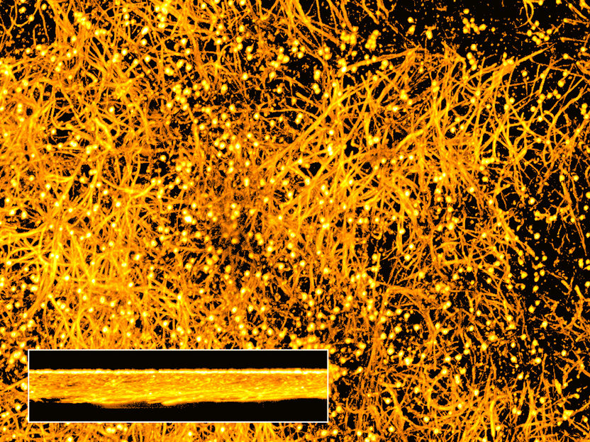 Candida’s hidden toolbox: Scientists discover a previously unknown infection strategy - A new study shows that the common blood protein albumin can turn otherwise harmless fungal strains of Candida albicans into dangerous pathogens