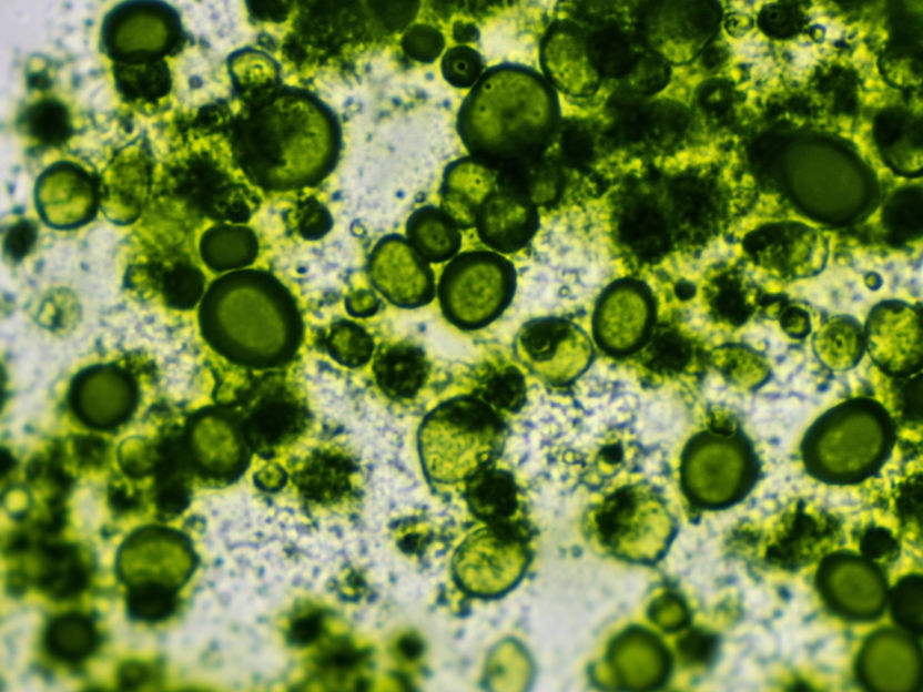 Cómo se producen los ácidos grasos omega-3 a partir de microalgas - Las microalgas como alternativa ecológica a la piscicultura
