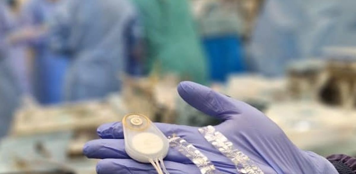 Première implantation humaine d'une interface cerveau-ordinateur en Allemagne