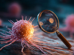 Una avanzada técnica de imagen detecta el cáncer con una precisión sin precedentes