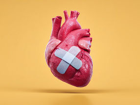 A Patch for the Heart