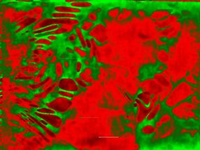 Lithium-Schwefel-Batterien mit wenig Elektrolyt: Problemzonen identifiziert