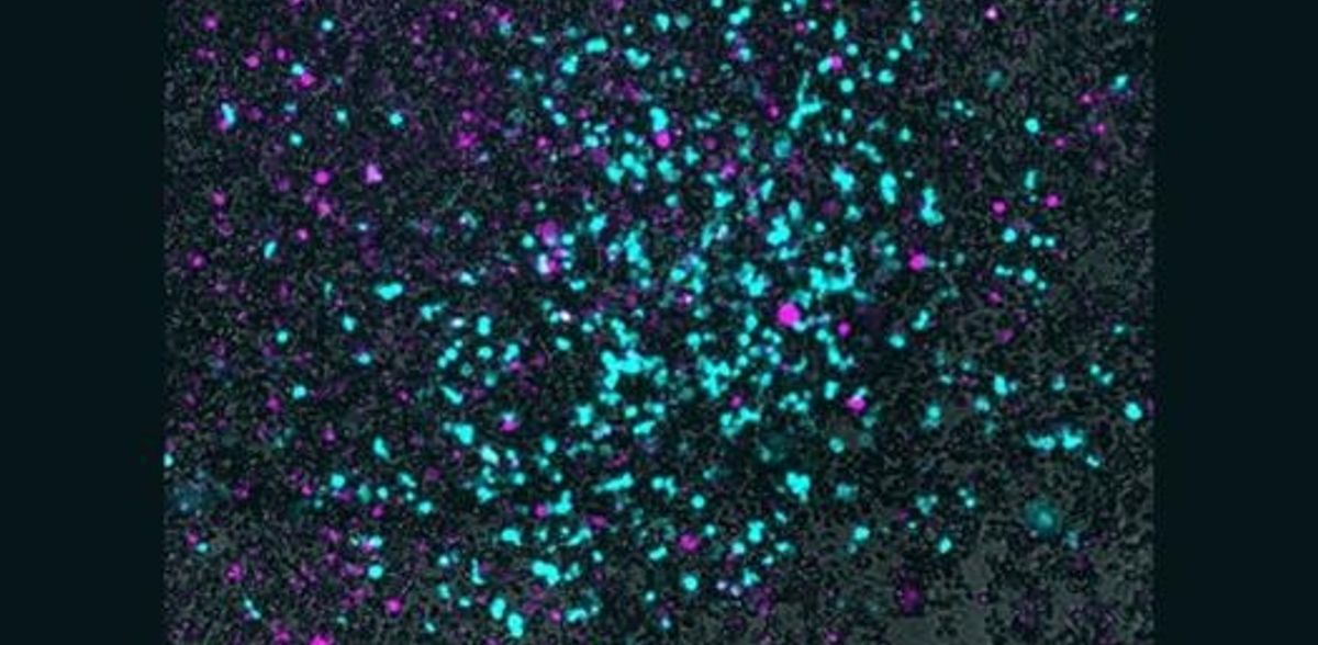 Utilização de bactérias para introduzir vírus em tumores