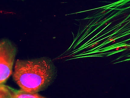 Cómo el cáncer hace que otras células trabajen para él