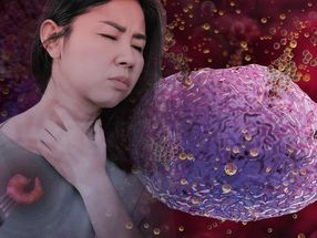 Entdeckung könnte zu neuen Behandlungen für lebensbedrohliche allergische Reaktionen führen