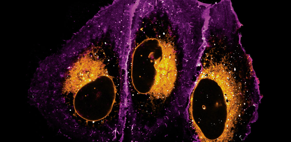 Copyright: Kristin Böhlig und Juan Iglesias-Artola / Nature (2025) / MPI-CBG