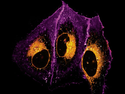Microscopia dei grassi: imaging dei lipidi nelle cellule
