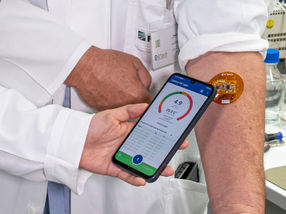 French start-up and Fraunhofer researchers aim to revolutionize patient monitoring