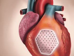 Groundbreaking therapy for advanced heart failure