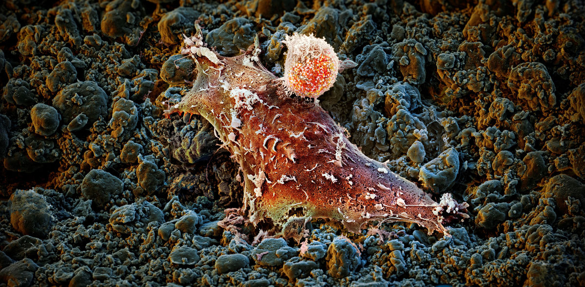 M Oeggerli (Micronaut 2019), M P Trefny, and A Zippelius, Translational Oncology, University Hospital Basel, supported by Pathology University Hospital Basel, and Bio-EM Lab, Biozentrum, University of Basel