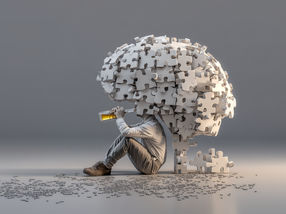Drinking any amount of alcohol likely increases dementia risk