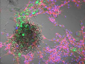 Nanoplastics detected in animal cells