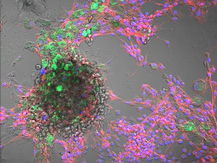 Des nanoplastiques détectés dans des cellules animales