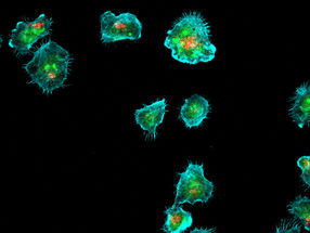How immune cells deliver their deadly cargo
