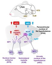 Fat or carbs?  The neural mechanism underlying food choices revealed