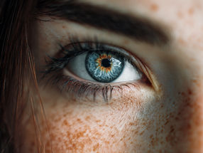 Una prótesis ocular devuelve la vista a pacientes con pérdida de visión incurable