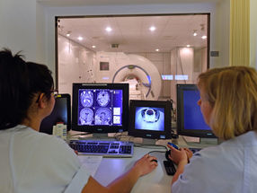 How sex hormones influence brain structure