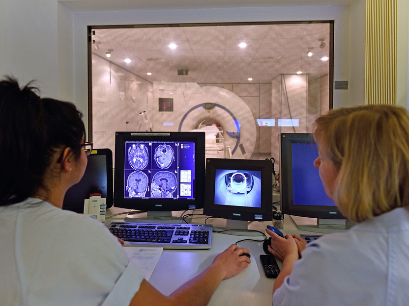 Come gli ormoni sessuali influenzano la struttura del cervello