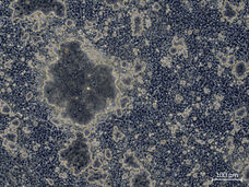 Genmodifizierung ermöglicht funktionalere Leberzellen aus Stammzellen