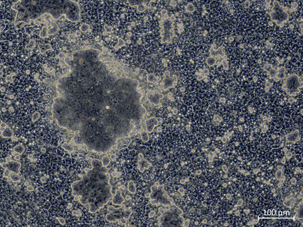 Genmodifizierung ermöglicht funktionalere Leberzellen aus Stammzellen