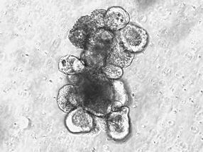 New evidence for the potential of microbiome-based therapies