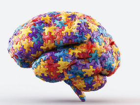 Neuartige Methode verbessert die Erkennung von Gehirnzuständen