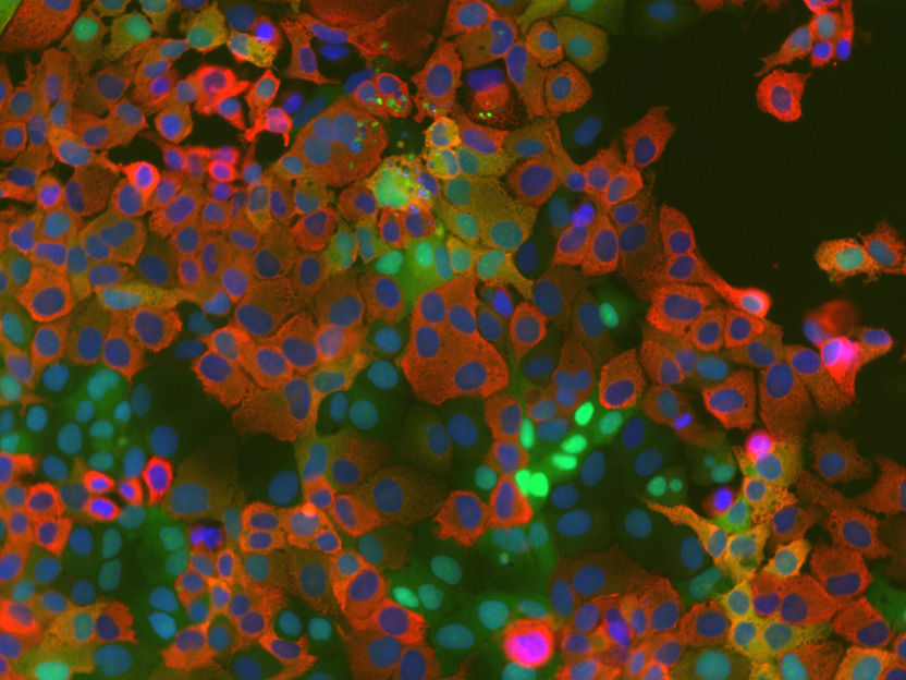 Meccanismo dell'ospite appena scoperto nei Coronavirus - La scoperta potrebbe servire come punto di partenza per strategie antivirali