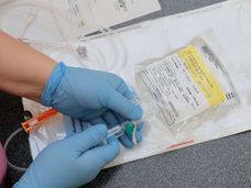 Primo paziente trattato con un nuovo farmaco per l'Alzheimer