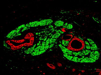 O cancro do pâncreas forma "sinapses"