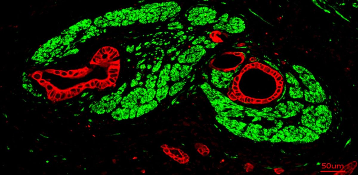 Ekin Demir / TUM, DOI: 10.1016/j.ccell.2025.09.003