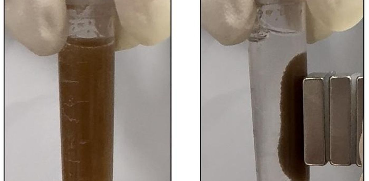 Le "pillole" di batteri potrebbero rilevare le malattie dell'intestino senza l'endoscopio