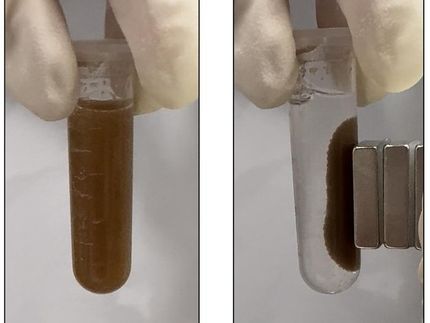 Bacteria ‘pills’ could detect gut diseases — without the endoscope