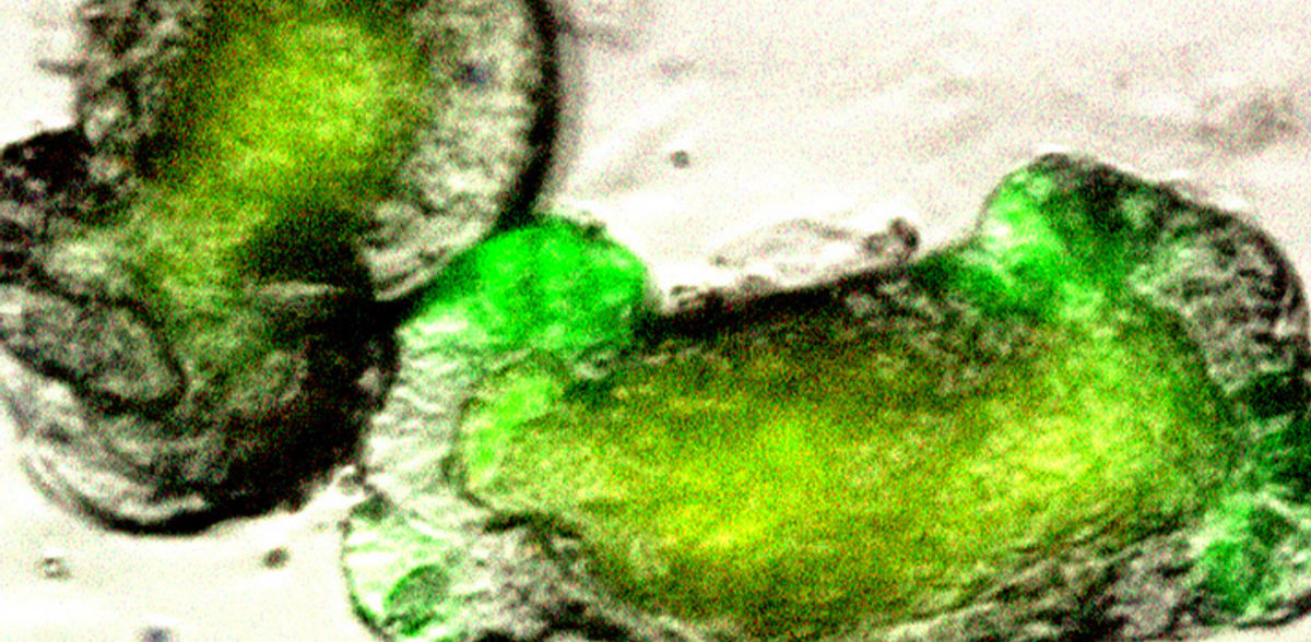 Fortalecer la barrera intestinal