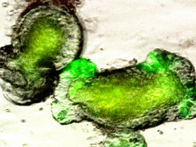 Fortalecer la barrera intestinal