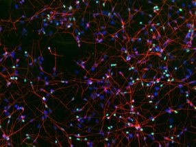 Defektes Enzym als Auslöser für Nervenverlust bei Demenz identifiziert