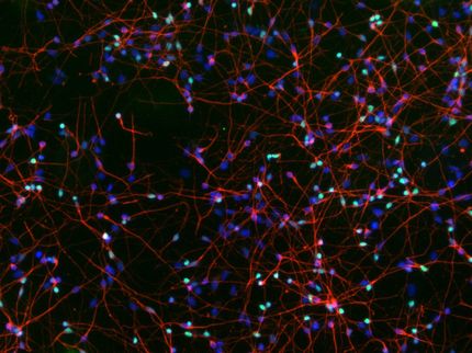 La défaillance d'une seule enzyme est à l'origine de la perte de neurones dans la démence