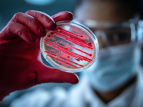 How bacteria resist enemy attacks