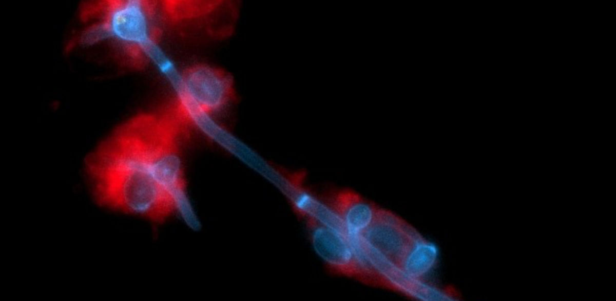 O sistema imunitário mantém os fungos das mucosas sob controlo