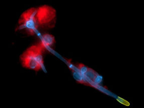 Immune system keeps mucosal fungi in check