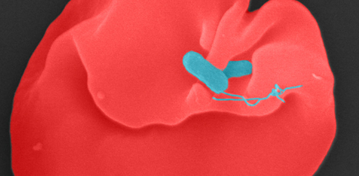 Enfermedad tropical Fiebre de Oroya: la elucidación del mecanismo de la enfermedad abre la posibilidad de una terapia novedosa