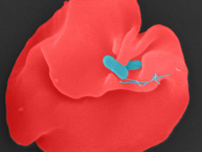 Tropenkrankheit Oroya-Fieber: Aufklärung des Krankheitsmechanismus eröffnet Möglichkeit neuartiger Therapie