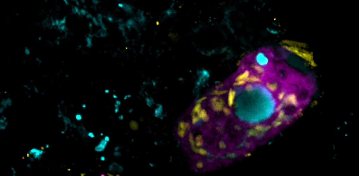 Aliados invisibles: las bacterias simbióticas ayudan a limpiar las aguas residuales, pero hay un truco