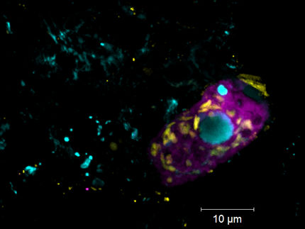 Aliados invisibles: las bacterias simbióticas ayudan a limpiar las aguas residuales, pero hay un truco