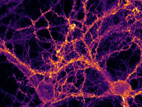 Regarder les synapses travailler