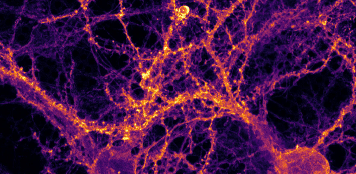 © Charité/Max Delbrück Center | Jana Kroll