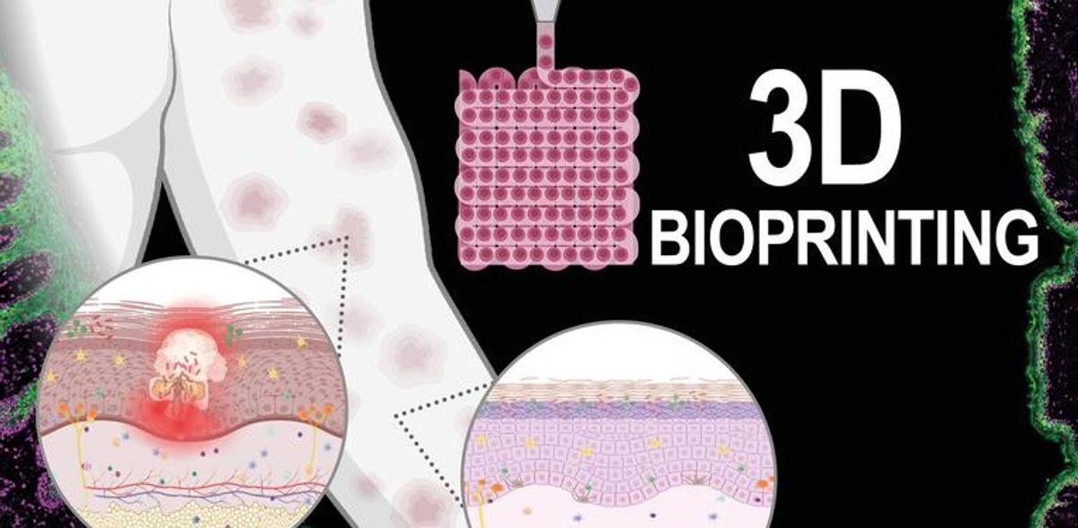 Combater doenças da pele com bioimpressão 3D